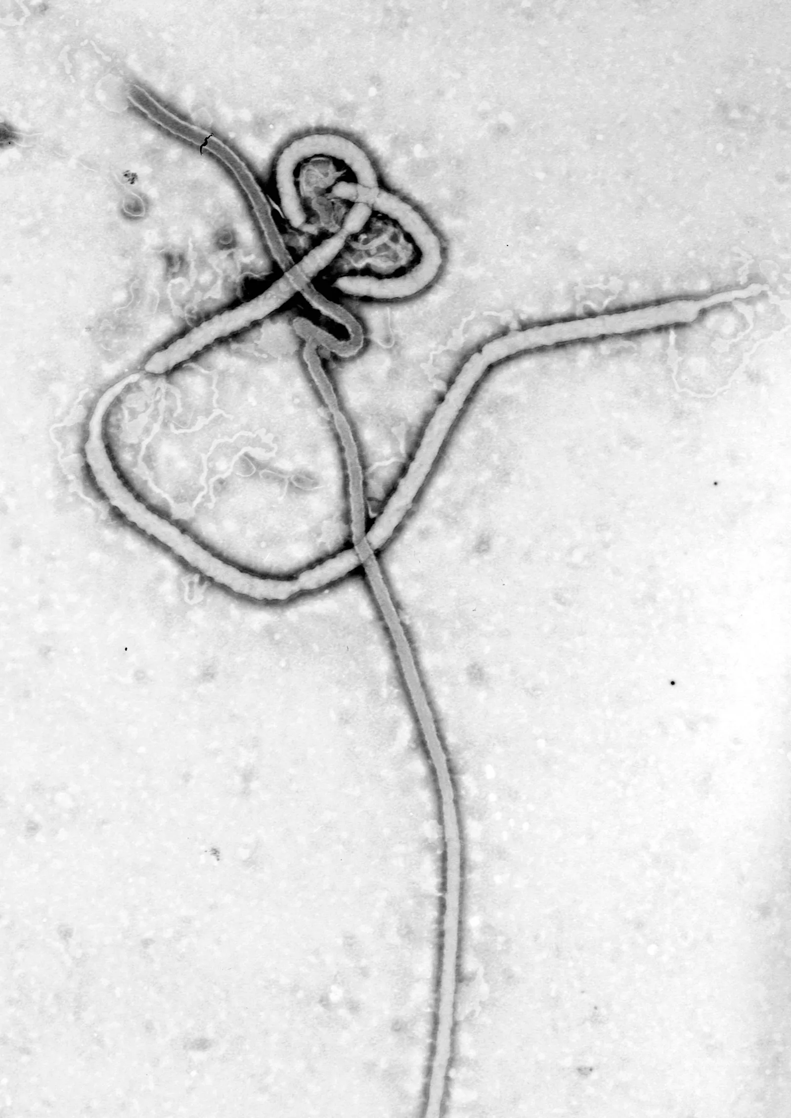 Wirus Ebola w mikroskopie elektronowym
